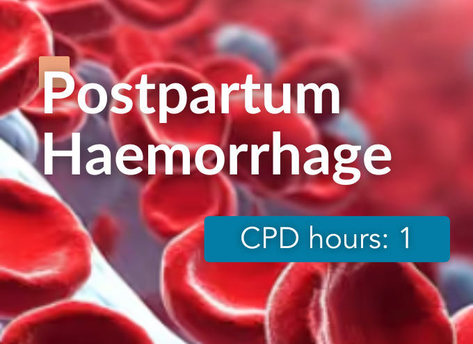 Postpartum Haemorrhage