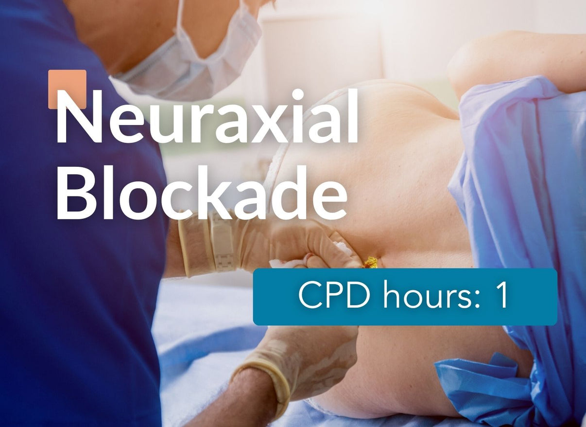 Neuraxial Blockade Epidural Anaesthesia Affinity Clinical Education